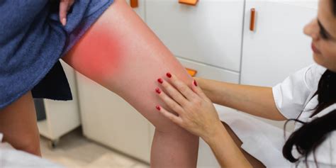 Pants Chafing Thighs at Richard Jett blog