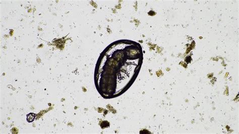 Turning Compost Pile Community Garden Compost Stock Footage Video (100% ...