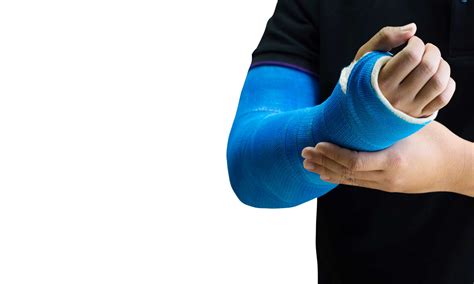 How to care for your kid’s cast | Norton Children&#039;s Louisville, Ky.
